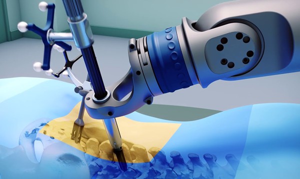 robot assisted surgery