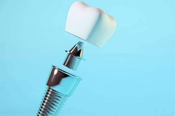 titanium for medical applications